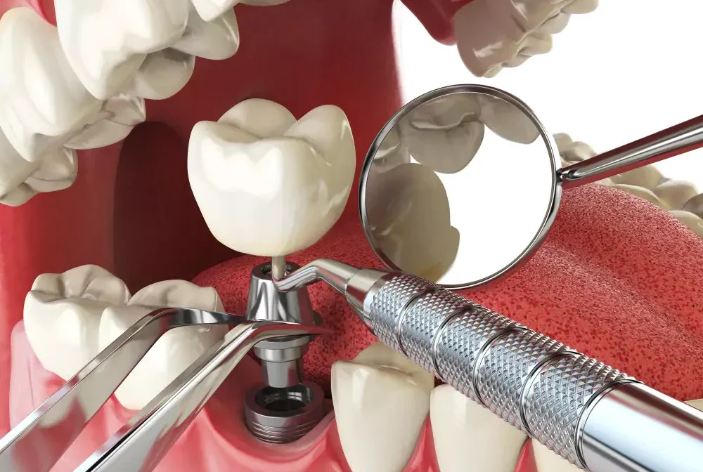 Dental_111131