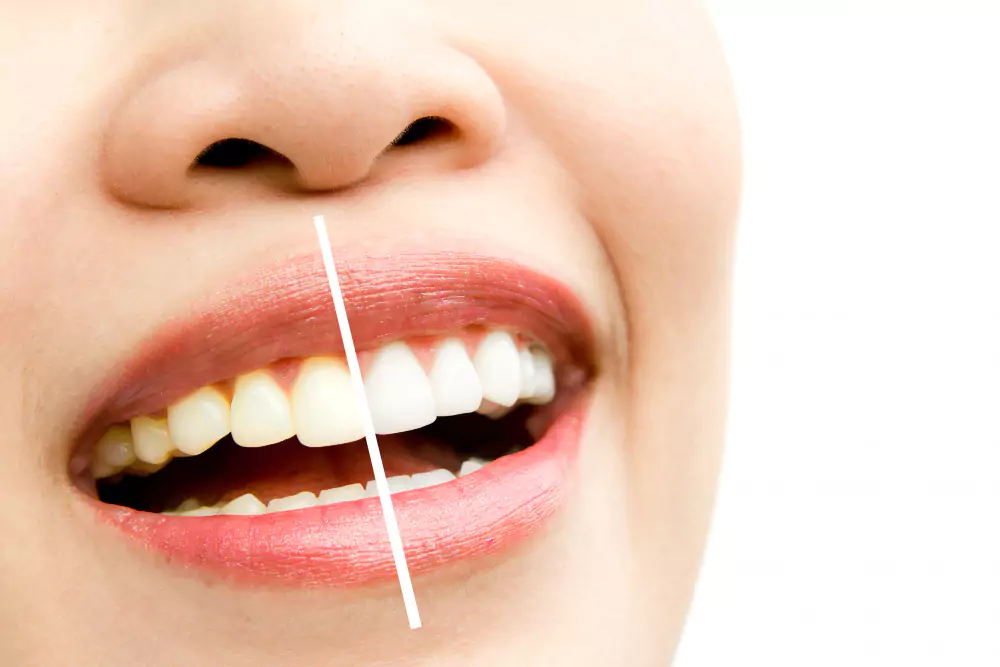 Dental_1111311
