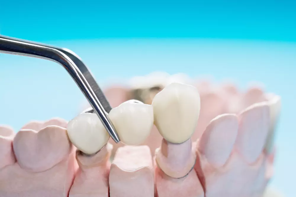 Dental_11113